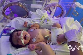 Lékaři chtěli ženě operovat obří nádor. Místo toho objevili plně donošené miminko